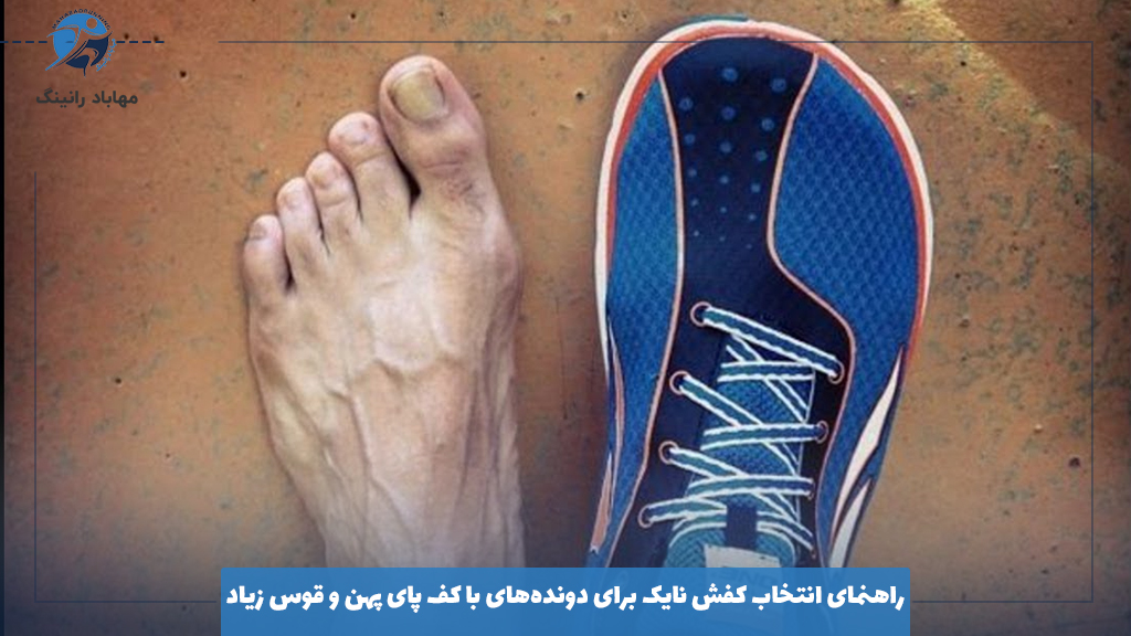 پاها با کف پهن و قوس زیاد چه ویژگی هایی دارند؟