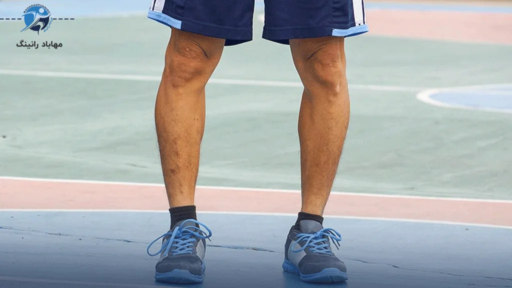 کتونی برای دویدن با زانوی پرانتزی باید چه ویژگی هایی داشته باشد؟